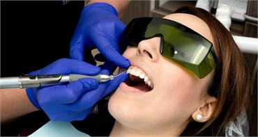 What Are The Ways Dentists Follow For Professional Teeth Whitening