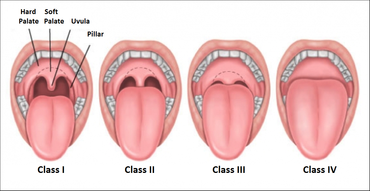 Uvula News Dentagama