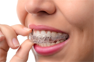 close up of woman with invisalign 