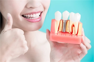 Dental Implants Miami FL