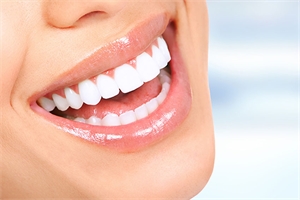 Teeth Whitening treatments