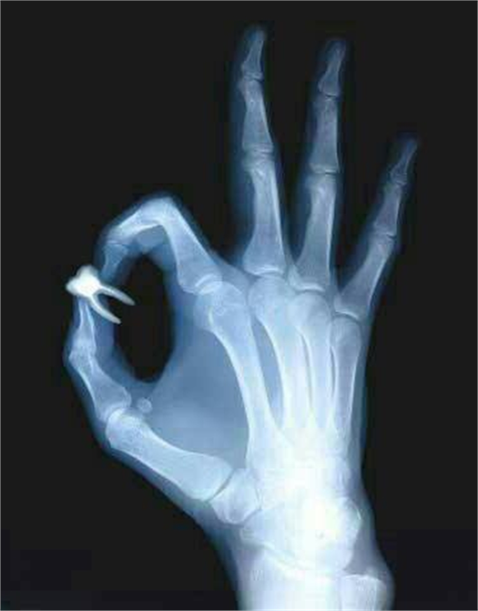 Dental Radiology Humor Dentagama