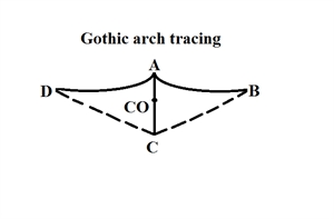 Gothic Arch Tracing
