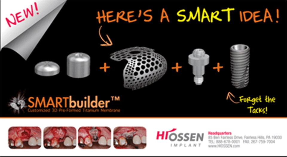 Hiossen Smart Builder