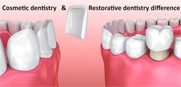 What Are the Differences Between Cosmetic and Restorative Dentistry?