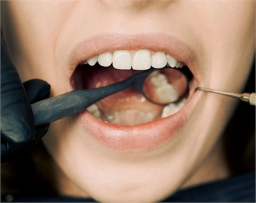 How Endodontics Can Save Your Natural Teeth