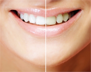 cosmetic dental treatment