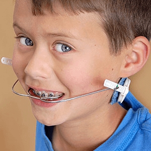The orthodontic headgear is an extra oral appliance used in orthodontics to correct severe bite problems by transferring forces to the teeth and jaws through facebow and J-hooks to the palatal expander or dental braces.
