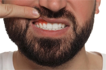Gum Health Matters: Understanding The Importance Of Gum Health In Oral Wellness