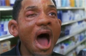Will Smith is having an anaphylactic shock in the Hitch movie