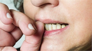 Effects of nail biting on oral health