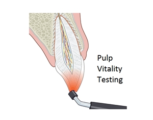 Pulp vitality test