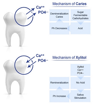 Demineralization of enamel is the first stage of tooth decay. Mechanisms of dental caries and xylitol teeth remineralization.