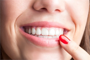 Know Why Dental Bonding Can Mend the Gap Between Your Teeth