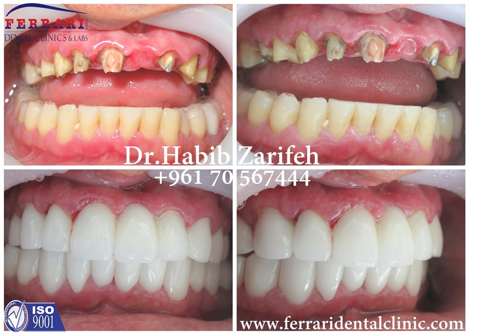 SmileJustTheWayYouFeel with Dr Habib Zarifeh