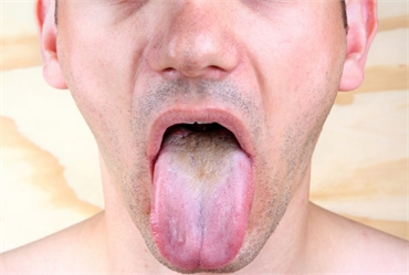 What Does it Mean When Your Tongue is