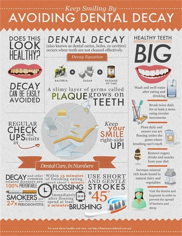 Avoiding Dental Decay 