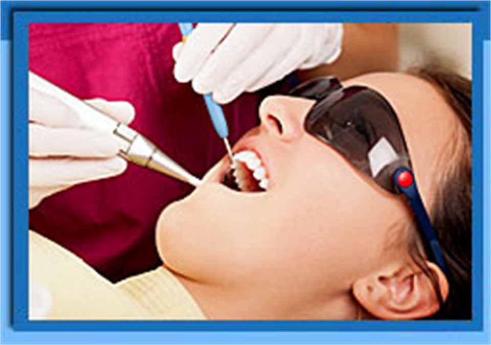 Root Canal Laser Treatment