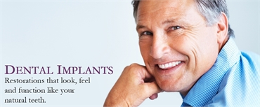 Dnetal Implants specialists Holladay Dental Excellence