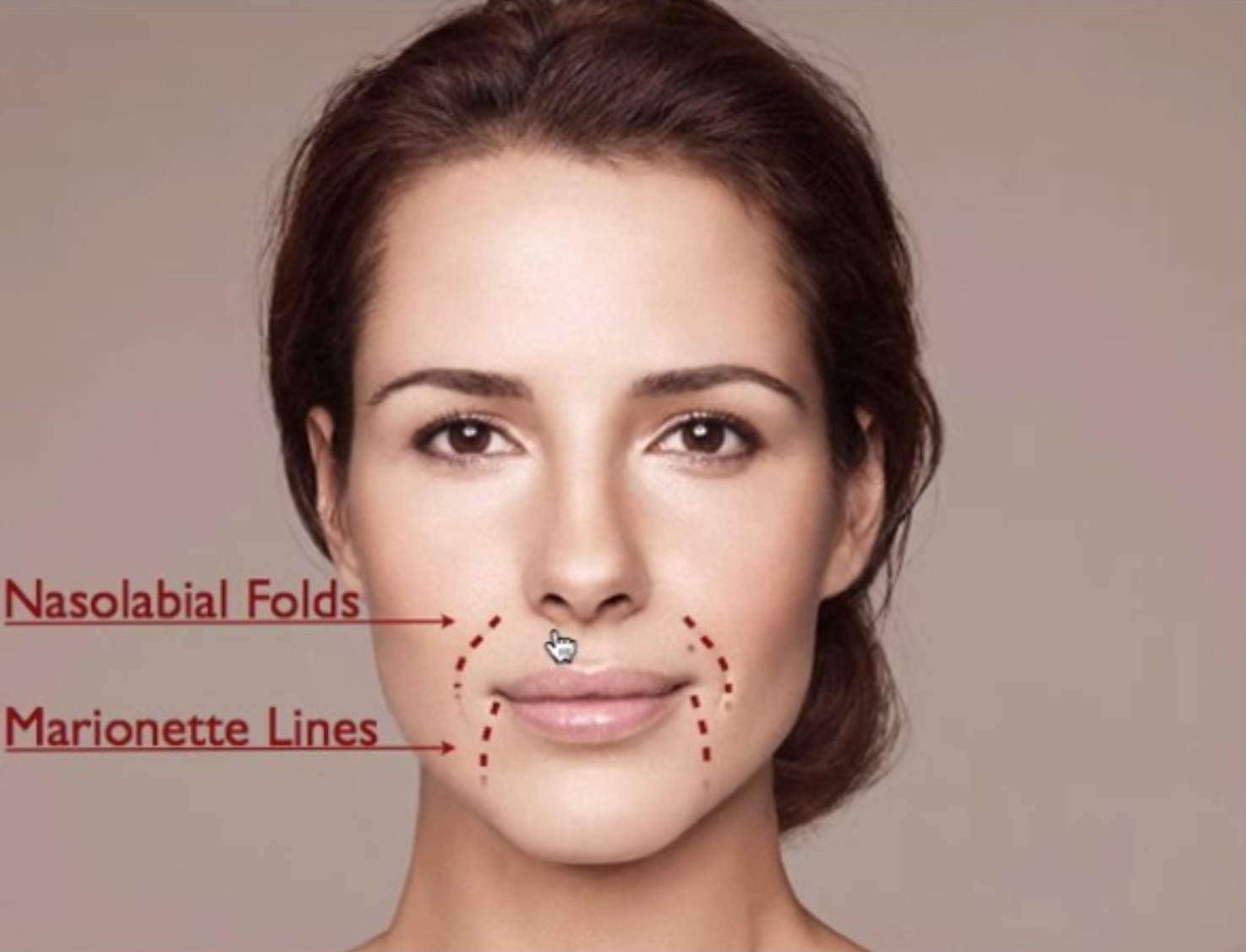 Facial exercises for marionette lines