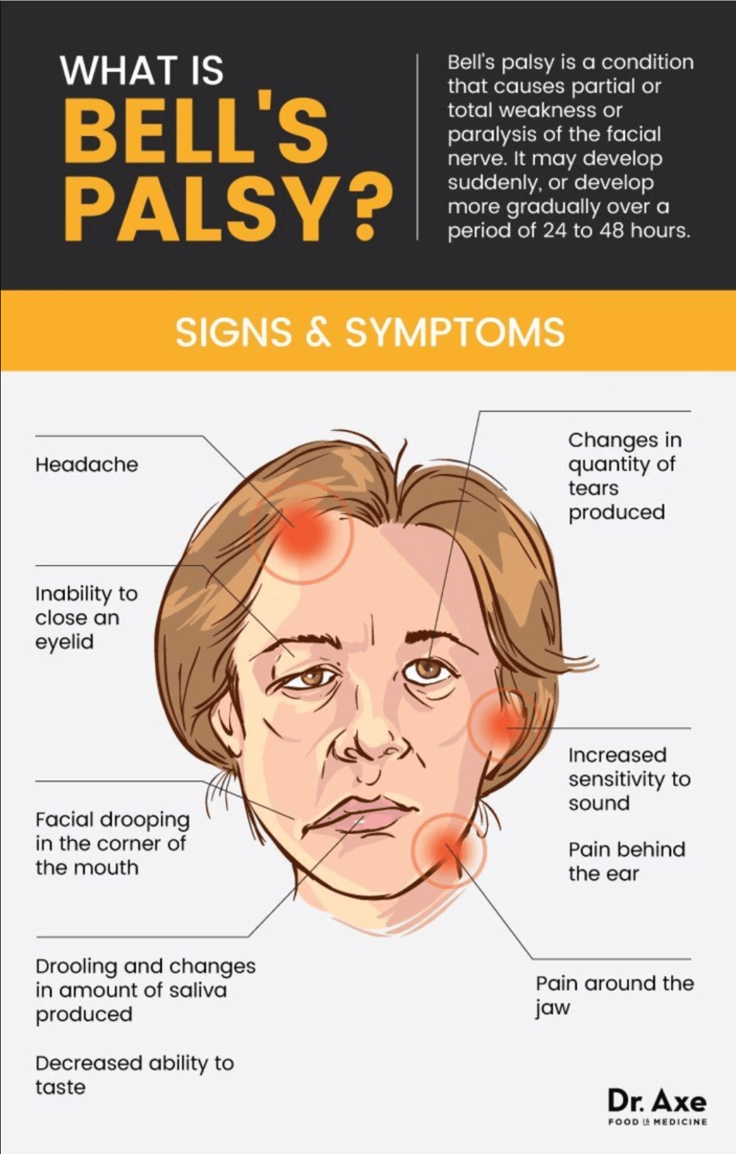Everything about Bell’s Palsy | News | Dentagama