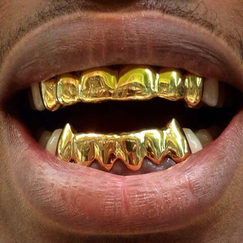 What are teeth grillz and bling bling removable teeth? | News | Dentagama