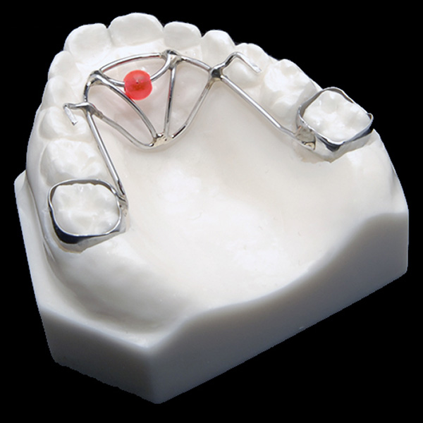 bluegrass-orthodontic-appliance-news-dentagama