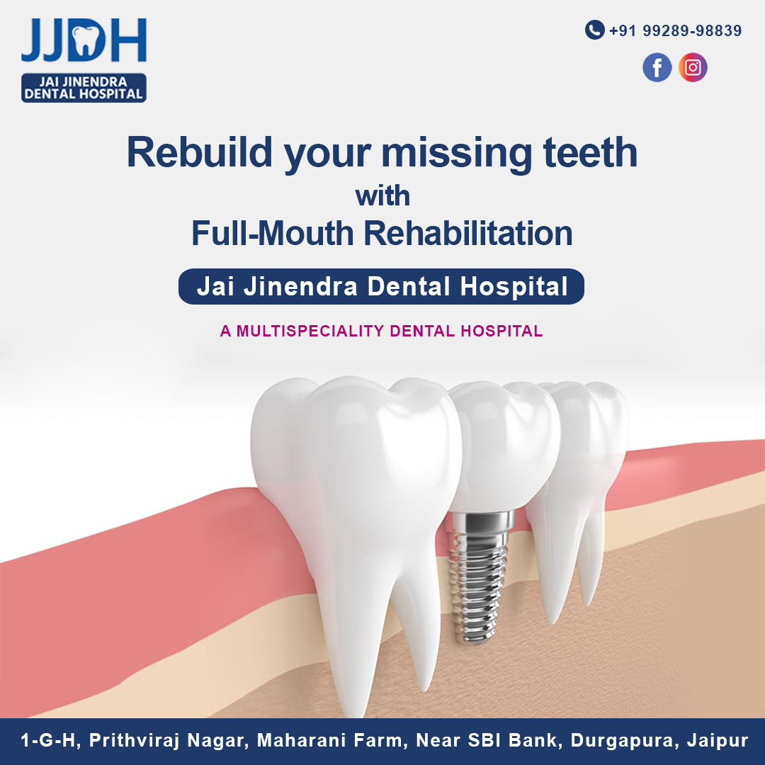 Rebuild your missing teeth with Full-Mouth Rehabilitation | Dentagama