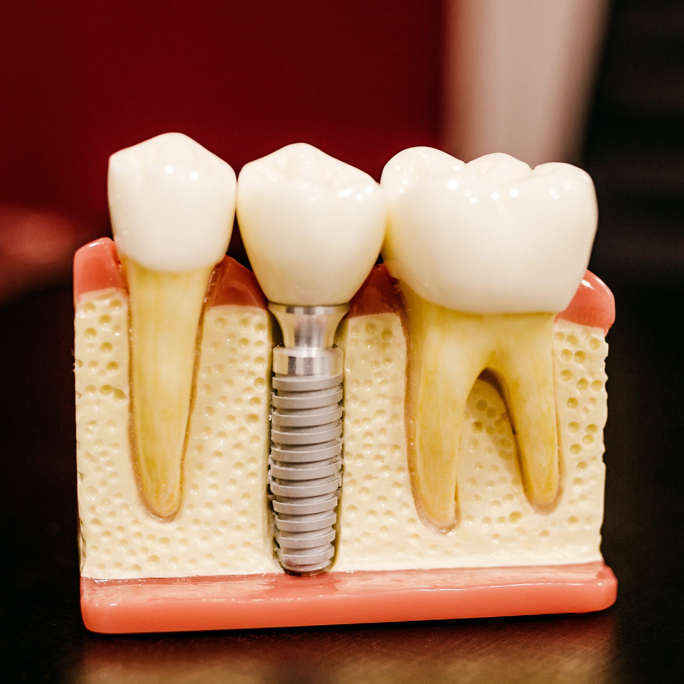 Orthodontic Treatment Dentagama