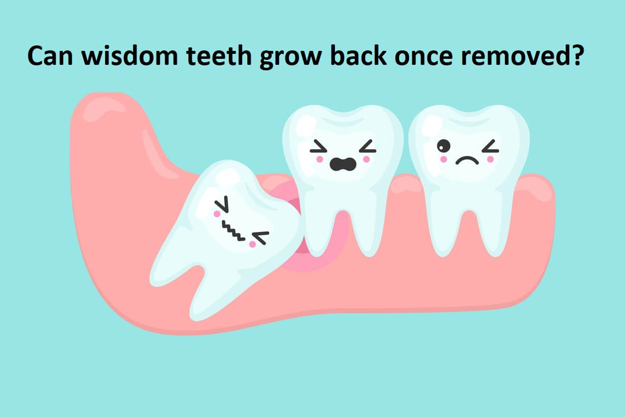 Can wisdom teeth grow back after extraction? | News | Dentagama