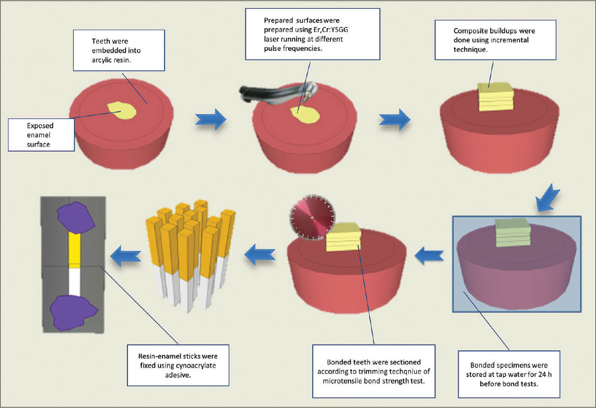 What Is Shear And Tensile Bond Strength Of Dental Resin Composite 