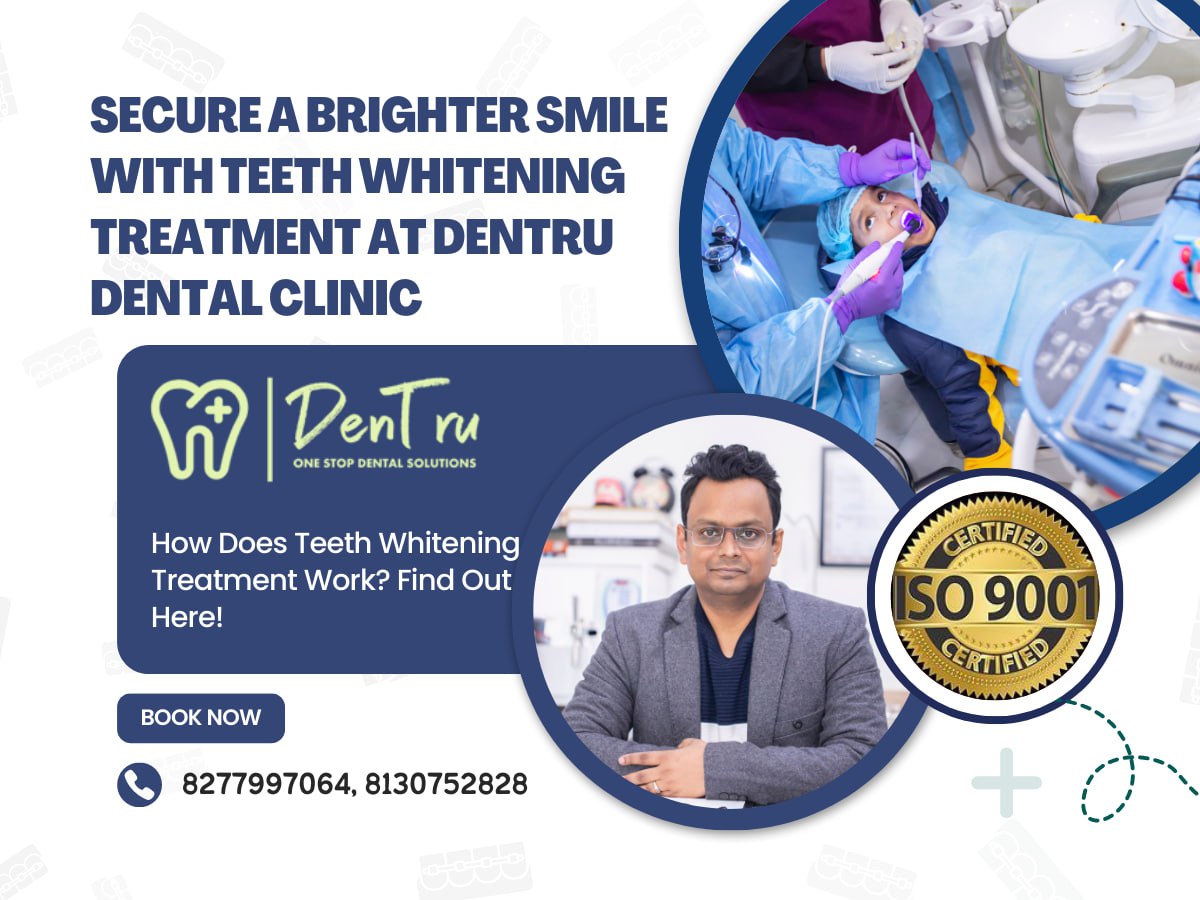 Best Teeth Whitening Treatment Provider In Gurgaon Dentru Oral And