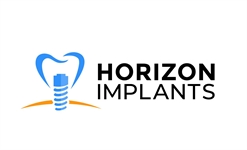 Horizon Implants 