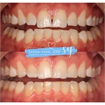 LP Dental of Falls Church