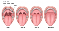 Uvula | News | Dentagama