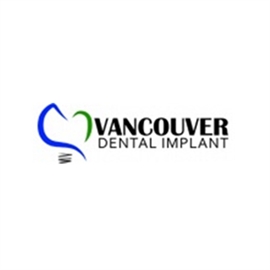 Vancouver Dental Implant