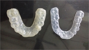 bruxism appliance edward tay