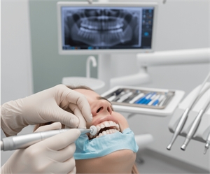 Advancing Oral Health: The Role of Polishing Pastes in Preventive Dentistry