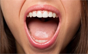 What to Do for Dry Mouth