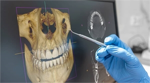 Why Is a 3D Dental Scan Important in Dentistry