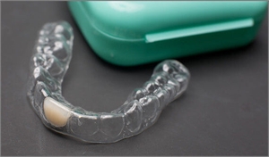 Transparent Essix retainer can quickly restore a gap in your dentition