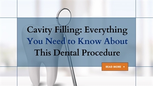 Cavity Filling: Everything You Need to Know About This Dental Procedure