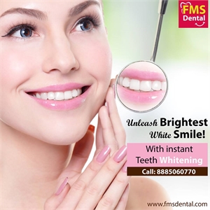 Tooth whitening / bleaching restores lost shine to your teeth and thus helps excel your confidence.