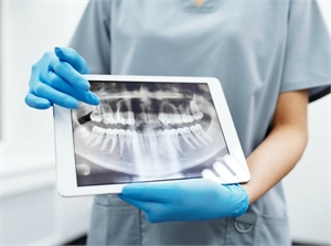 OPT x-ray shown on a tablet