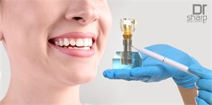 Oral Rehabilitation Miami