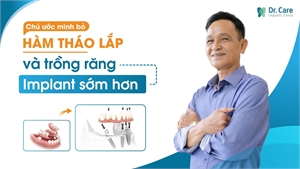 Chu uoc minh bo ham thao lap som de chon trong rang implant