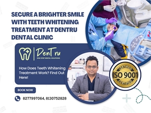 Best Teeth whitening provider in gurgaon
