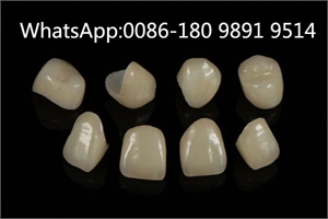 Chinese Dental Lab Denture