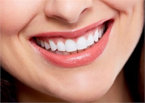 Best smile makeover in tambaram