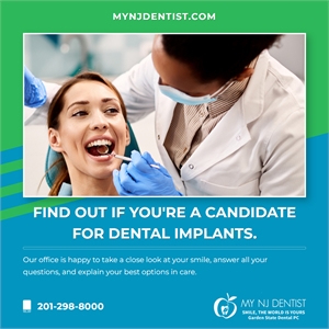 Dental Implants